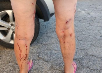 Mulher é atacada por cães durante caminhada em Laguna